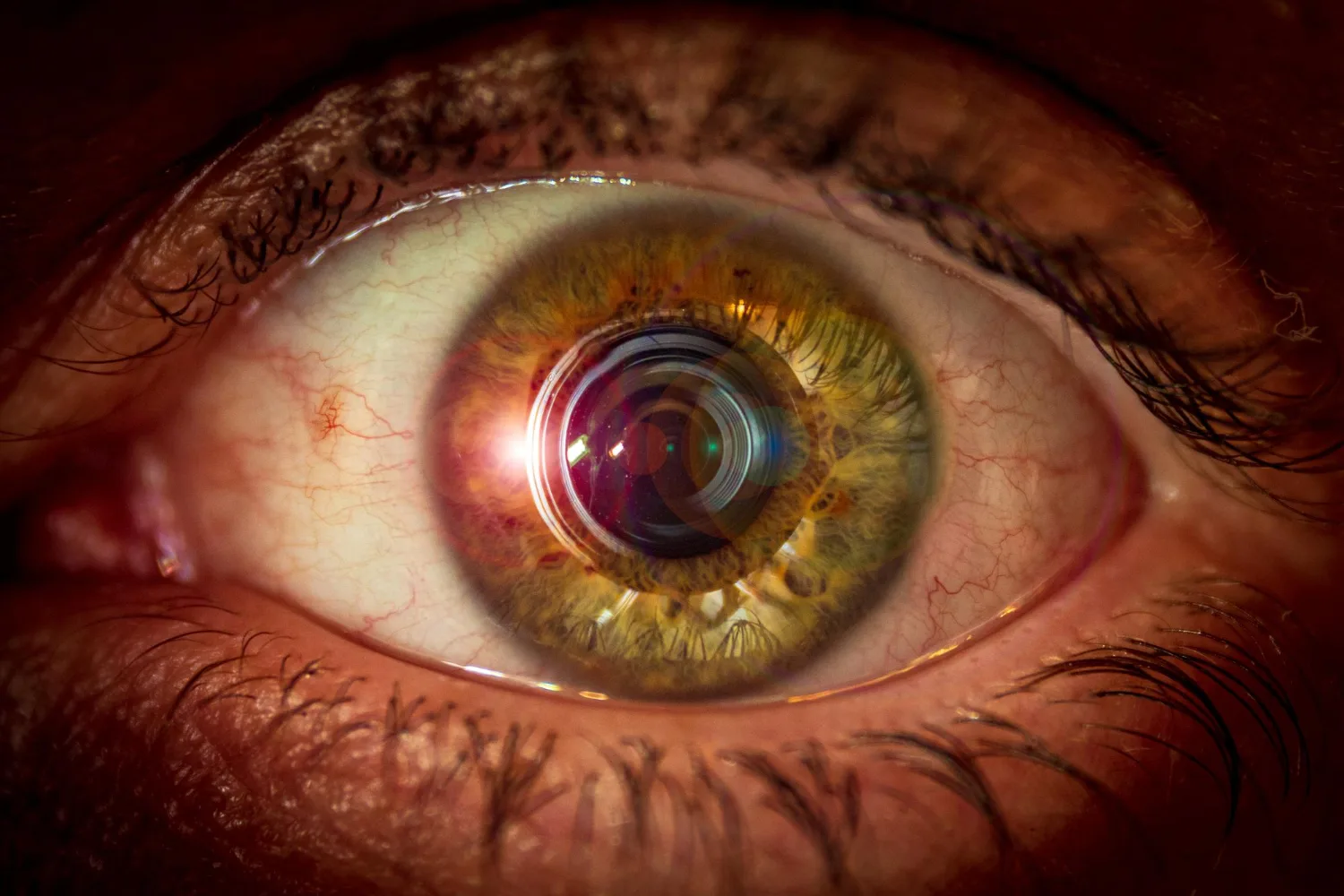 Membranas epirretinianas